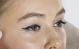 Blepharoplasty